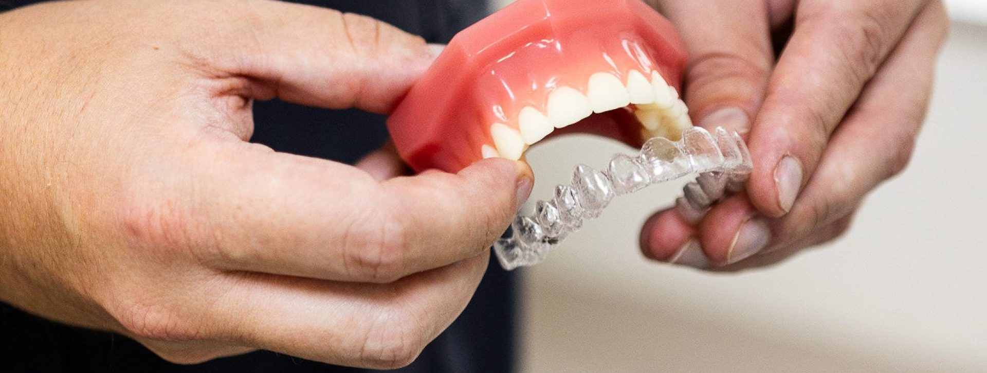 Clear
Aligners